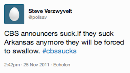 CBS sucks
