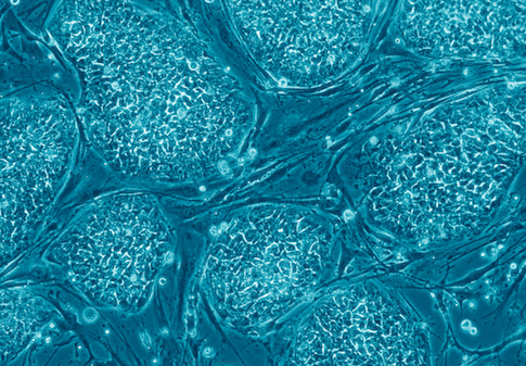 embryonic stem cells
