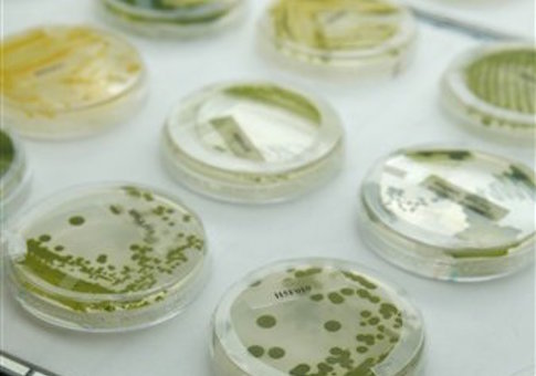 Strains of algae are shown in the strain room of Solazyme in South San Francisco, Calif.