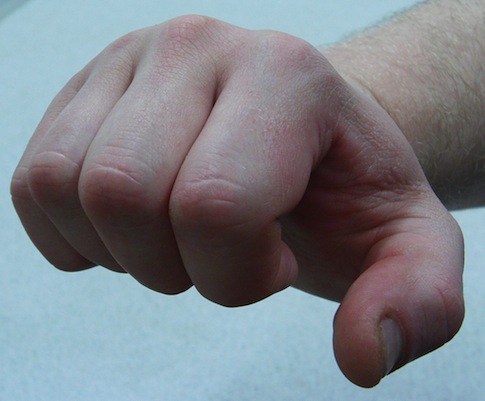 Fists Killed More in New York than Rifles in 2011
