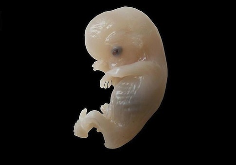 Embryo Frozen for 19 Years Adopted