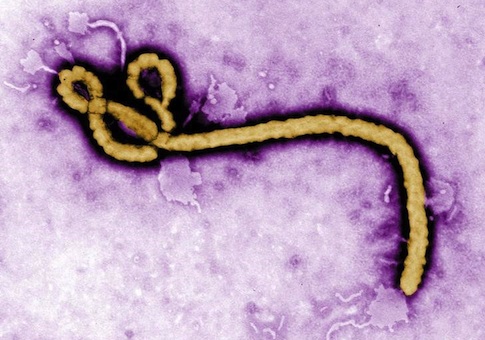 State Department Denies Own Memo of Plan to Bring Non-Citizens to US for Ebola Treatment