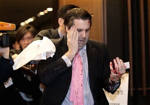 U.S. Ambassador Injured in Attack