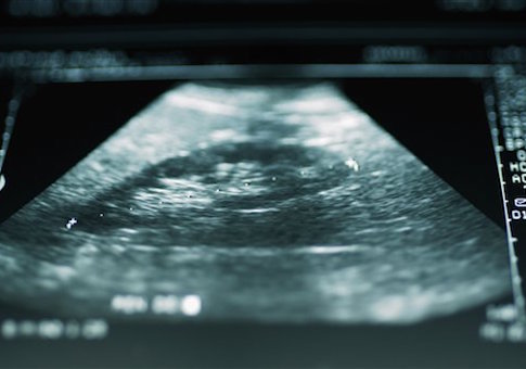 Taxpayers Paid for Intact Human Fetal Brains From StemExpress