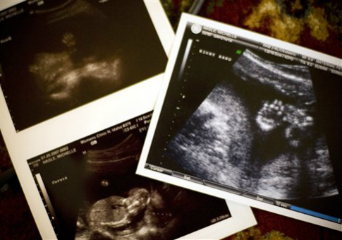Magazine Retracts Claim That Fetal Heartbeats Are 'Imaginary'