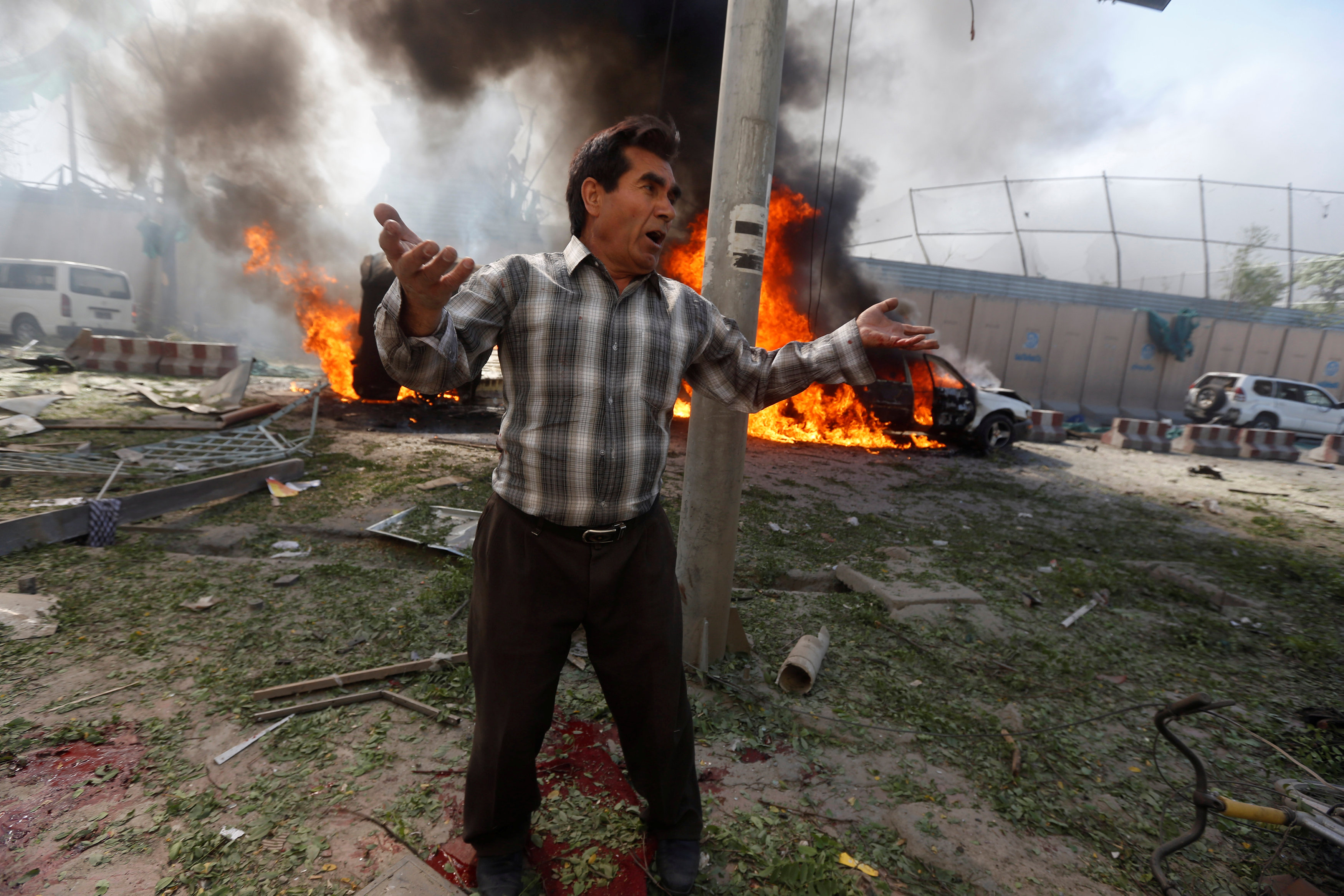 Huge Bomb in Sewage Tanker Kills at Least 80, Wounds Hundreds in Afghan Capital