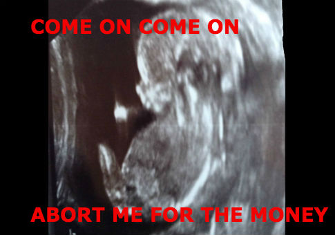 More Proof That Abortion *Is* What Democrats Mean By 'the Economy'