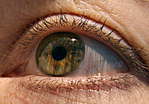 Medicaid Patients With Glaucoma Received Less Testing Than Those With Commercial Health Insurance