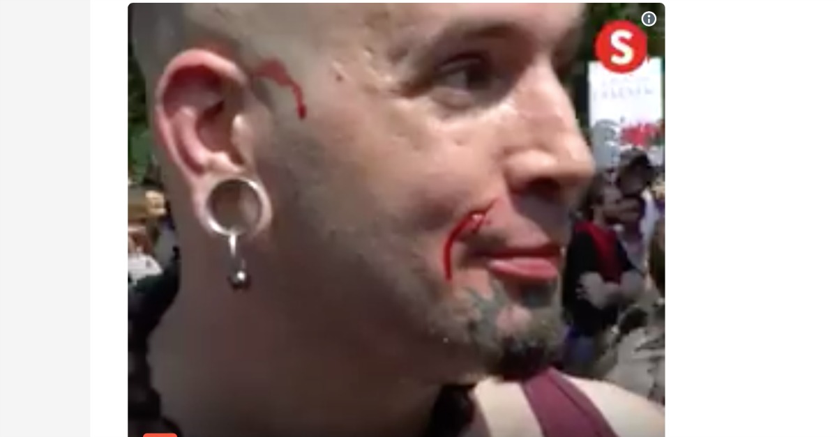 Boston Antifa Protester Attacked by Fellow Activist After Being Mistaken for Neo-Nazi