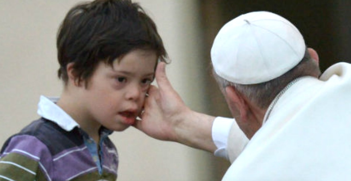 Down Syndrome Children Nearly Eliminated from One Country Through Abortion