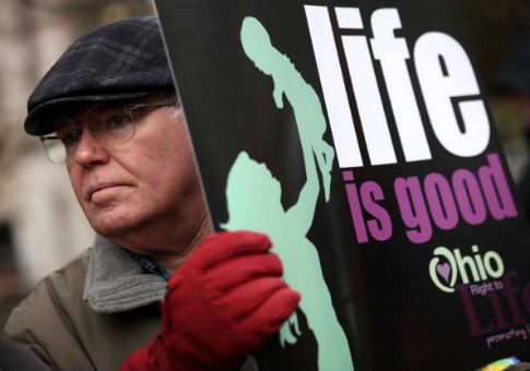 ACLU Plans to Challenge Ohio's Abortion Ban on Fetuses With Down Syndrome