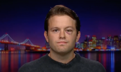 Police Still Searching for Man Who Punched Conservative Activist in Face at Berkeley