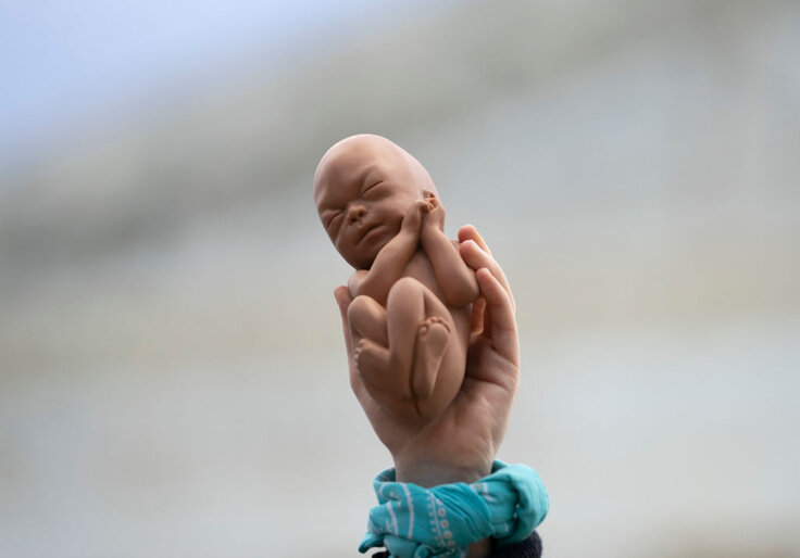 A Post-Roe Playbook