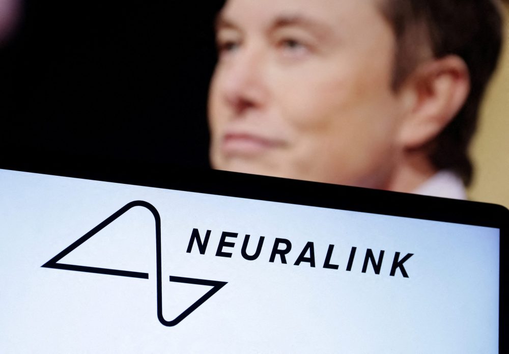 Elon Musk Wins FDA Approval To Test Brain Implants in Humans