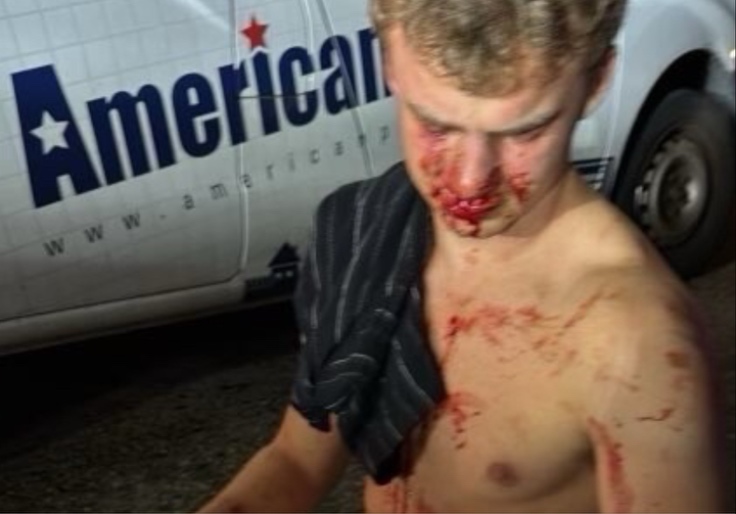 Teens Who Brutally Attacked Trump Admin Staffer in DC Avoid Jail Time